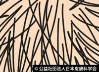 図X:人種による頭髪の違い