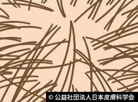 健常人