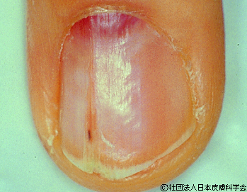 資料22：グロムス腫瘍