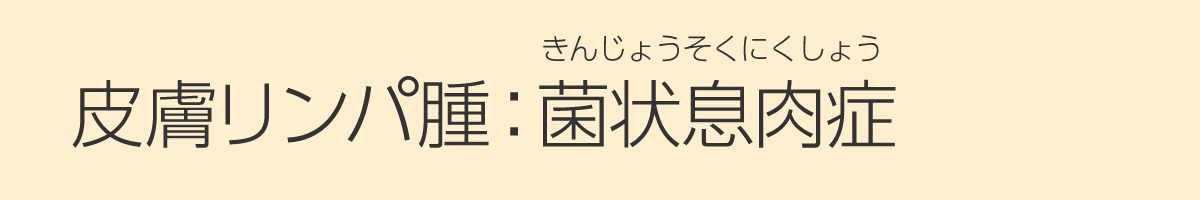 皮膚リンパ腫：菌状息肉症（きんじょうそくにくしょう）