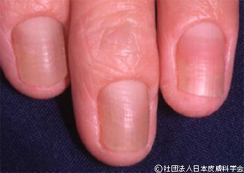 37歳、女性。初診時